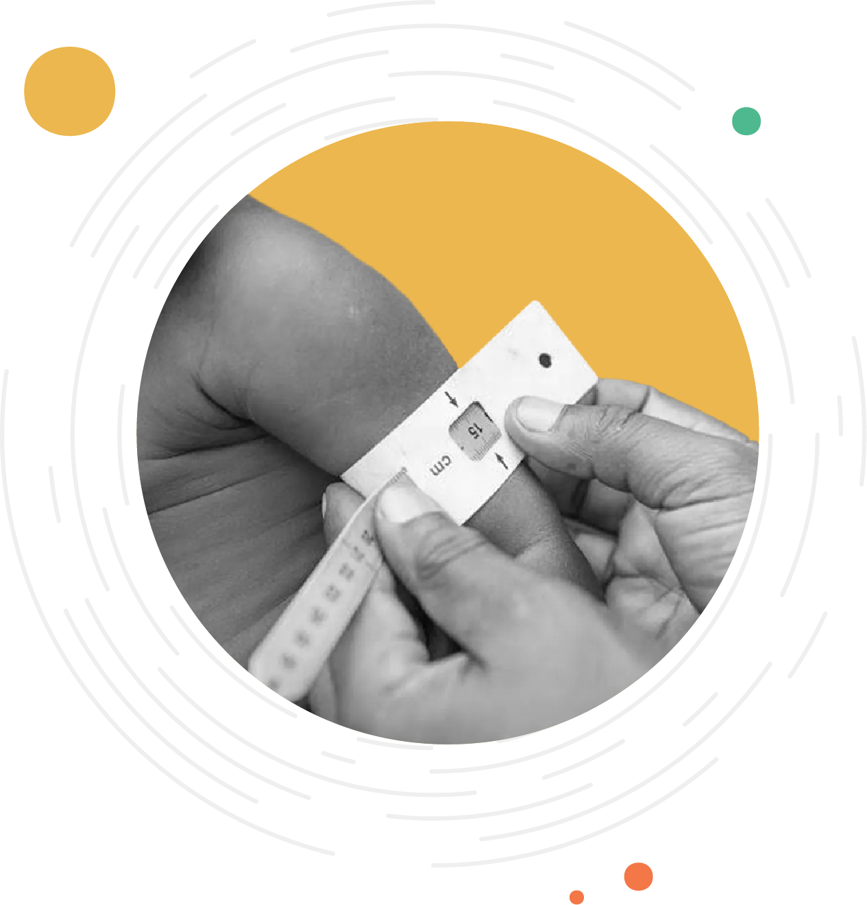 NUTRITION SURVEILLANCE SYSTEM ACU